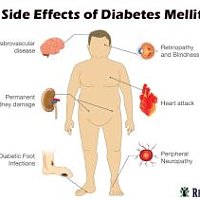 What are Side effect of Diabetes Mellitus?