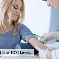 Things to know about Low hCG levels