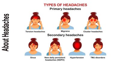 Headaches - Types and Symptoms