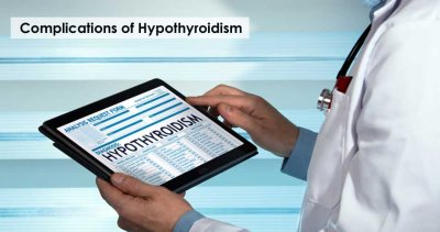 Complications of Hypothyroidism: A Comprehensive Guide for You