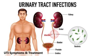 Urinary Tract Infections: Symptoms, Causes, and Treatment