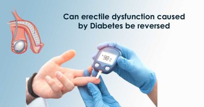 Can Erectile Dysfunction Caused by Diabetes be Reversed?