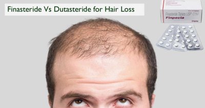 Finasteride vs Dutasteride: Which medication is best for hair growth?