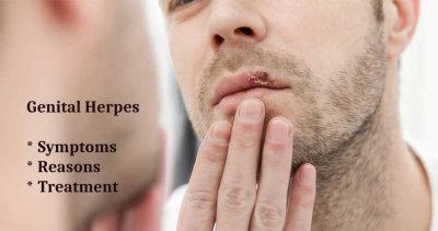 Genital Herpes- A sexually transmitted Infection