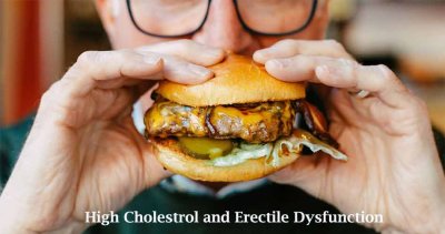 Link Between High Cholesterol and Erectile Dysfunction (ED)