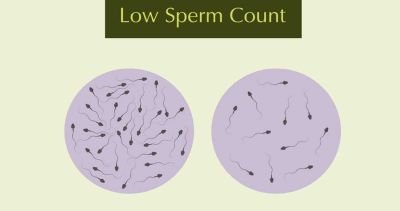 Low Sperm Count : Sign and Causes