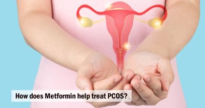 How does Metformin help treat PCOS?