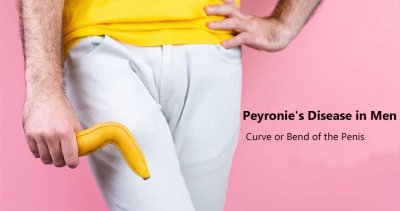 Peyronie's Disease in Men